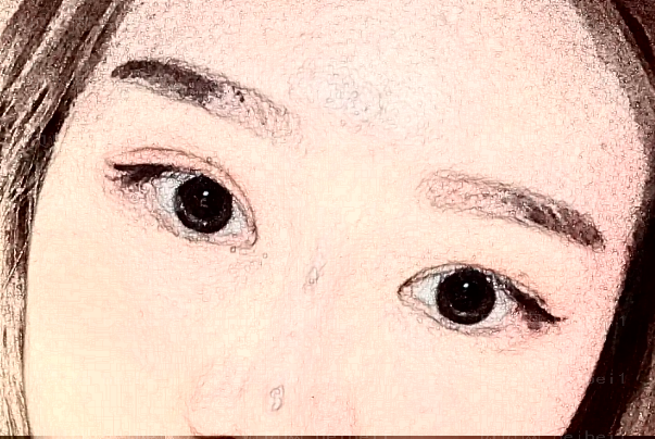 上海百达丽去眼袋失败修复怎么样？