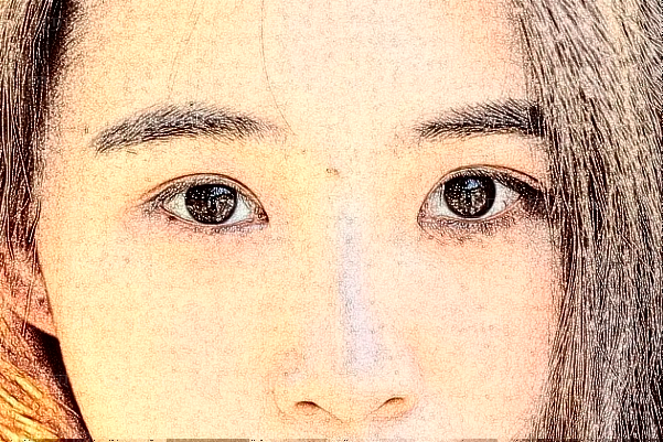 郑州缔莱美去眼袋失败修复怎么样？