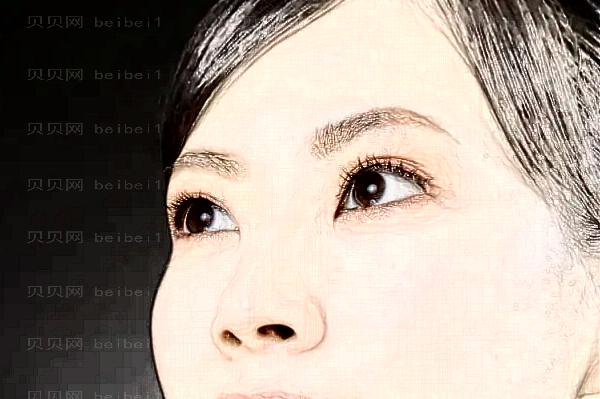 上海百达丽胶原蛋白去鱼尾纹张程医生好不好？