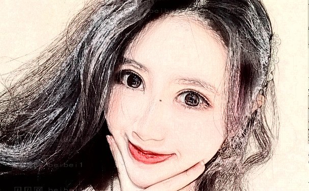成都友谊医院张立天长曲线截骨价格是多少？技术如何？案例评测