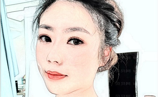 重庆铜雀台廖雪梅拉皮做得怎么样？技术评价+手术案例